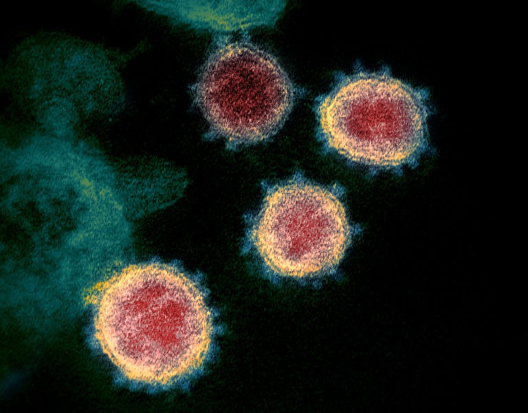 Electron micrograph of SARS-CoV-2 virions with visible coronae - foto preluat de pe en.wikipedia.org
